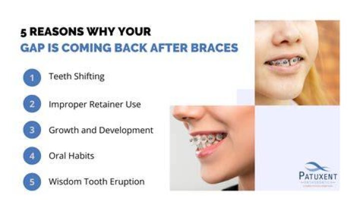 Do gaps come back after braces?