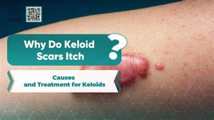 Do scars itch after 2 months?
