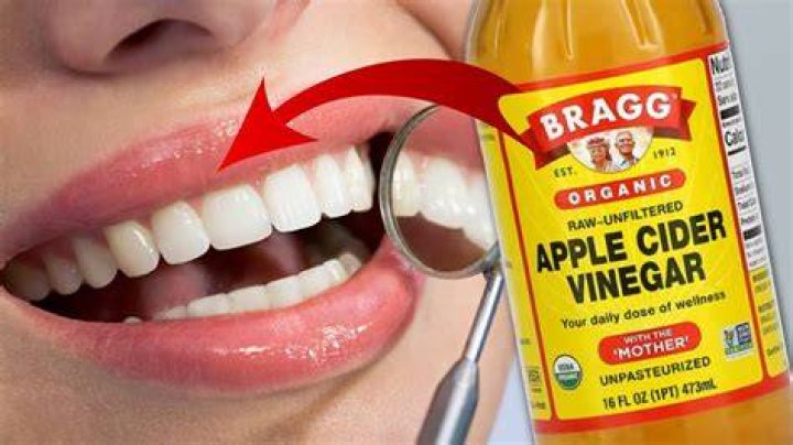 Does vinegar damage tooth enamel?