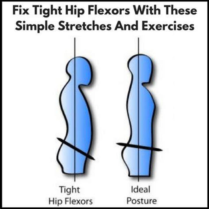 How do you fix tight hip flexors?