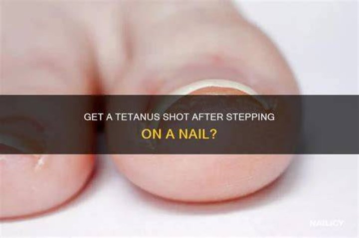 How soon should I get a tetanus shot after stepping on a nail?