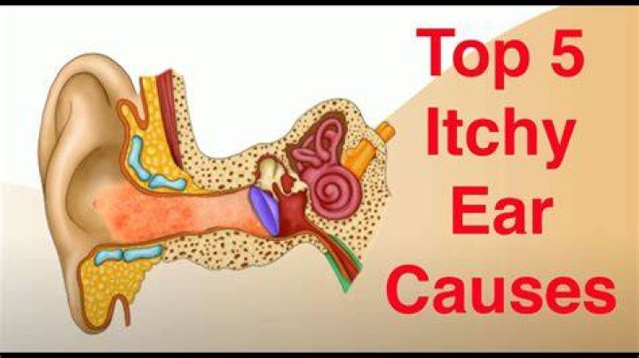 What do itchy ears want to hear?